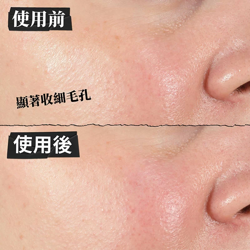 醫學高效保濕精華套裝